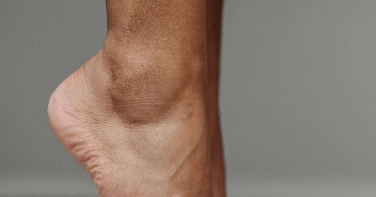 A bare foot rising onto the toes, raising the medial arch - best shoes for arch support, Podiatrist Tested